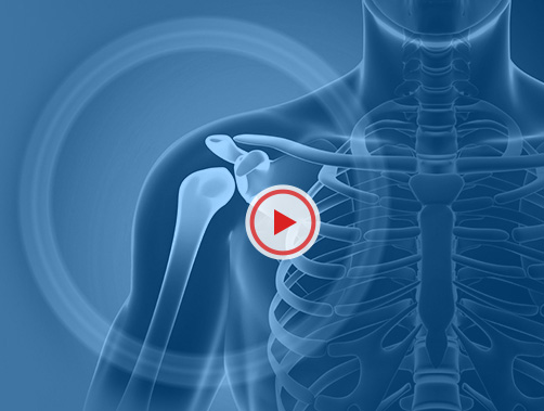Patient Educational Videos