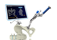 Computer-assisted Hip Replacement