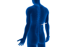 Minimally Invasive Spinal Surgery
